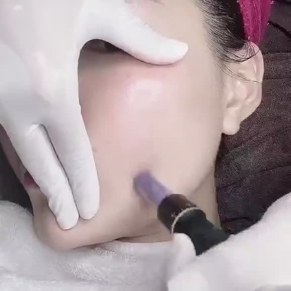 Kim nano Kim 12-36 dành cho máy Dr pen cấy tinh chất phi kịm sẹo rỗ trong spa | BigBuy360 - bigbuy360.vn