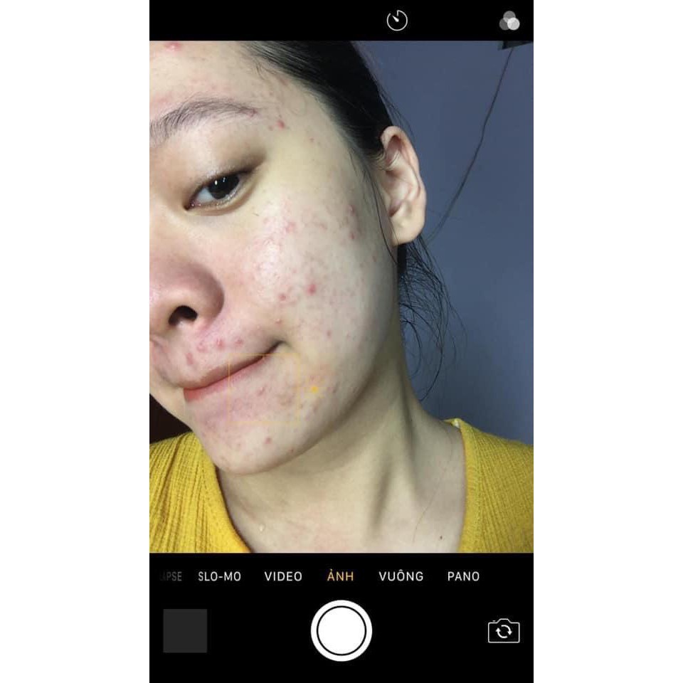 Serum đường đen Black Sugar Ist Essence 5ml - PBEAUTY CHÍNH HÃNG