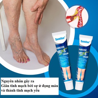 Gel bôi hỗ trợ điều trị bệnh giãn tĩnh mạch