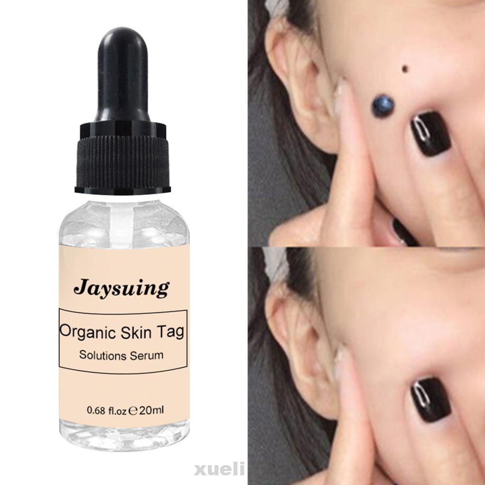 (Hàng Mới Về) Serum Trị Mụn Cóc Không Đau 20ml Tiện Dụng