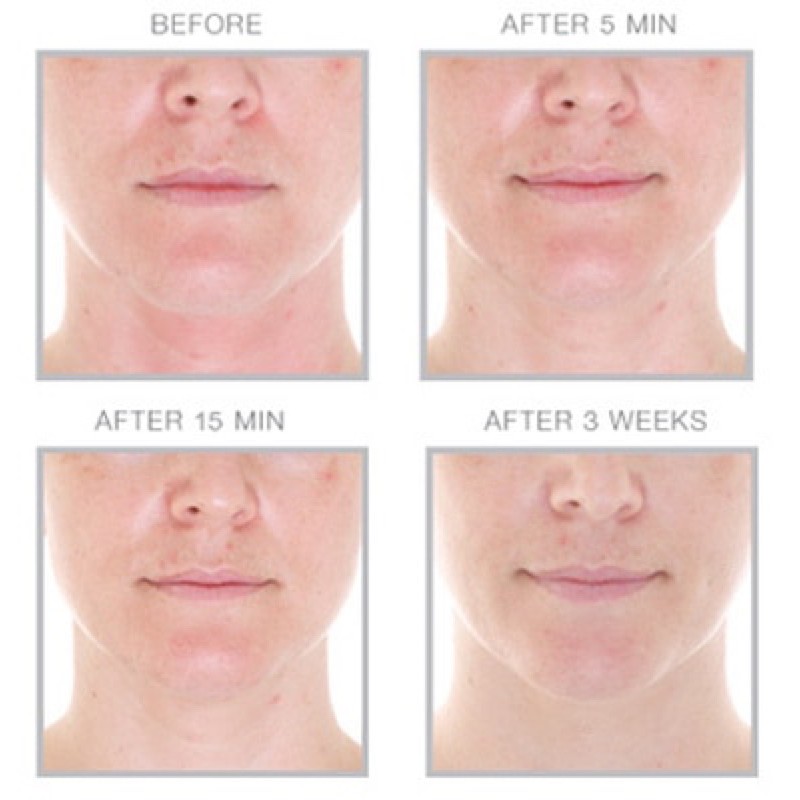 Serum phục hồi tái tạo da Cosmedix C.P.R Skin Recovery Serum