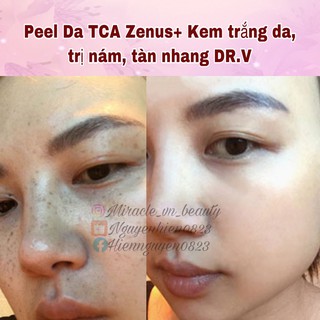 Kem Dưỡng Da Hàn Quốc DR.V
