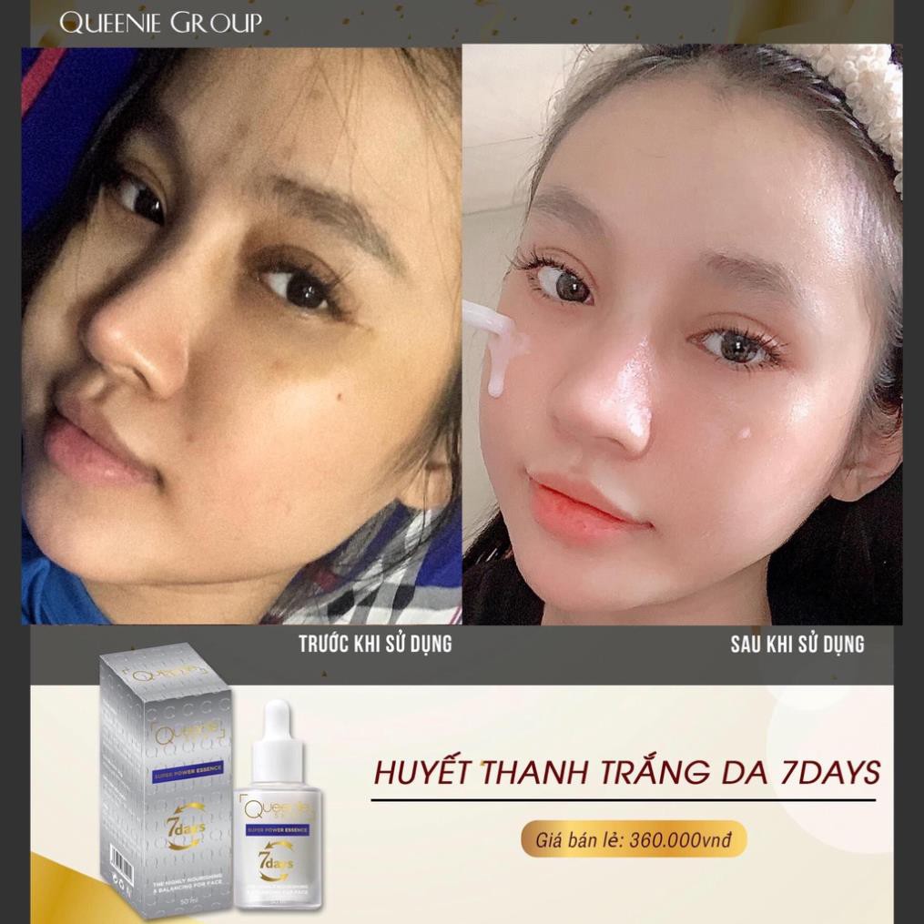 Serum Huyết Thanh Trắng Da 7 Days Queenie Skin