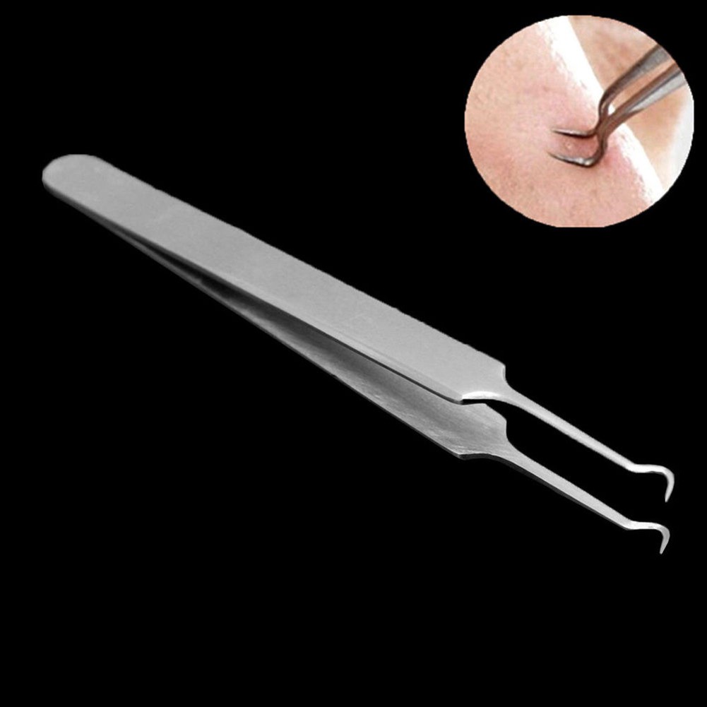Nhíp đầu cong nhỏ kích thước 8.7cm dùng để nặn mụn đầu đen tiện dụng