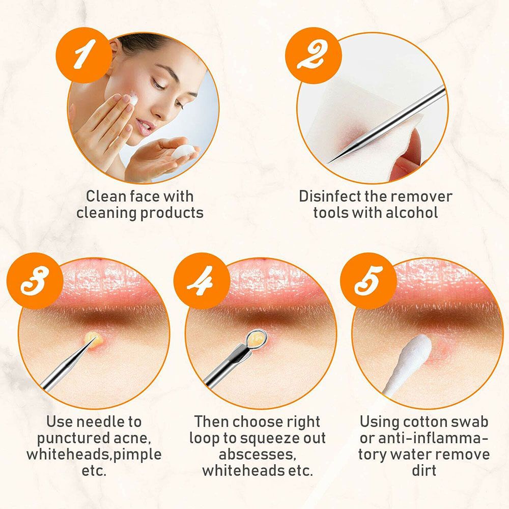 Set dụng cụ nặn mụn đầu đen bằng thép không gỉ thiết kế chuyên nghiệp kèm túi đựng