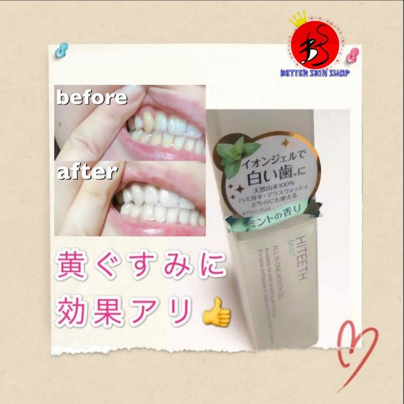 Gel tẩy trắng răng Nhật Bản Hiteeth All In One Gel 35ml
