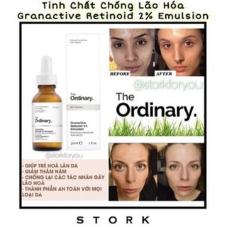 Có bill 🇺🇸 Tinh Chất Chống Lão Hóa THE ORDINARY. Granactive Retinoid 2% Emulsion