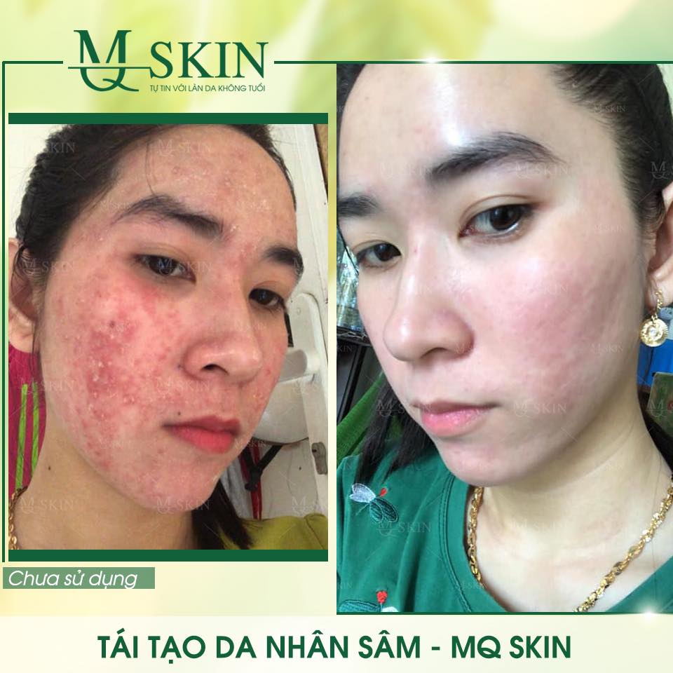 BB Cream tái tạo da MQ SKIN