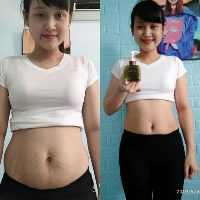 kem tan mỡ GOSLIM .mua kem tan mỡ tặng ngay đai nịt bụng sịn Sò nhé các chị em