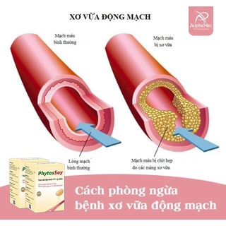 Phytos Soy - Mỡ máu, gan nhiễm mỡ(Hỗ trợ giảm 50k)