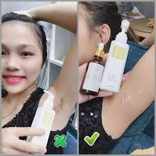 [Hàng Cao Cấp] - Combo Kem Tẩy Lông Huyền Phi Triệt Sạch Bất Chấp Các Loại Lông | BigBuy360 - bigbuy360.vn