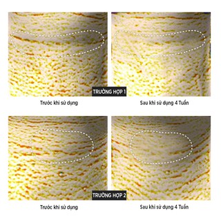 Kem Dưỡng Cổ Naite Thread Neck Medi Peel