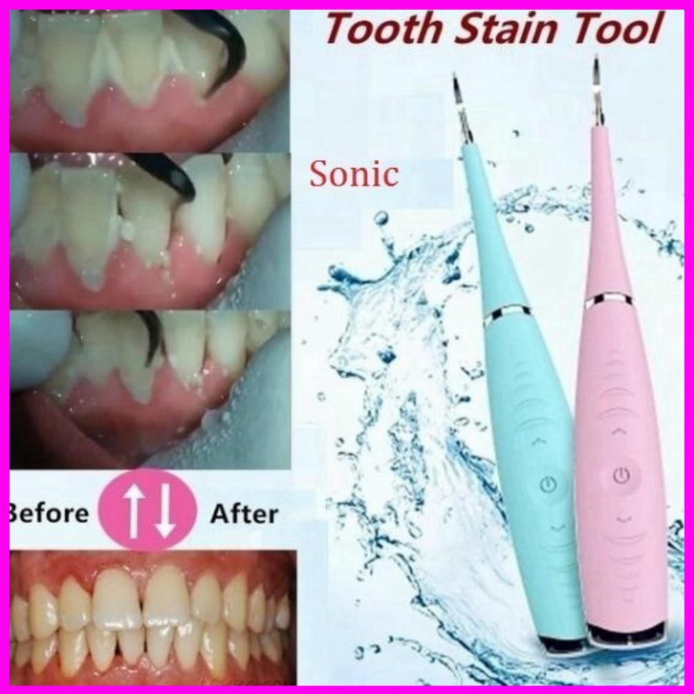 [BÁN CHẠY] Dụng cụ lấy cao răng tại nhà sonicpic - máy hút cao răng - máy sạc pin