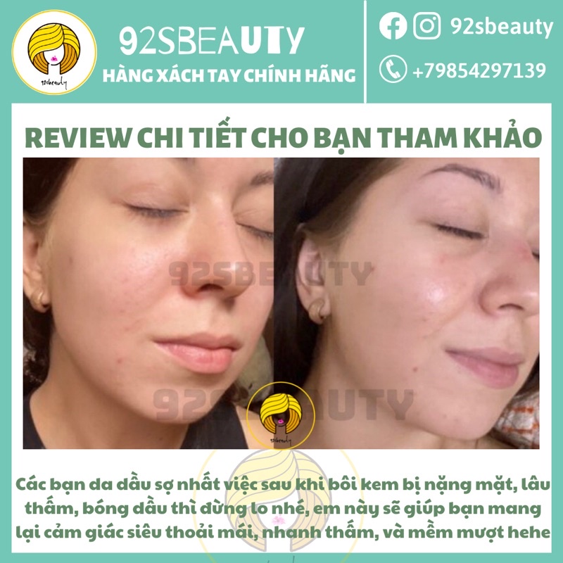 Kem dưỡng cho da mụn Eveline Glycol Therapy 7% ngừa mụn, mờ thâm