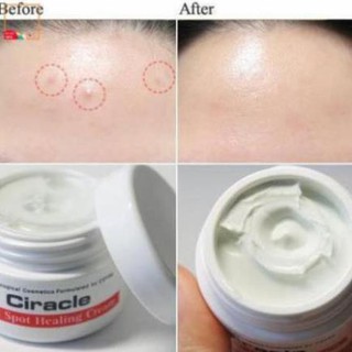 Kem Trị Mụn Ciracle Red Spot Healing Cream