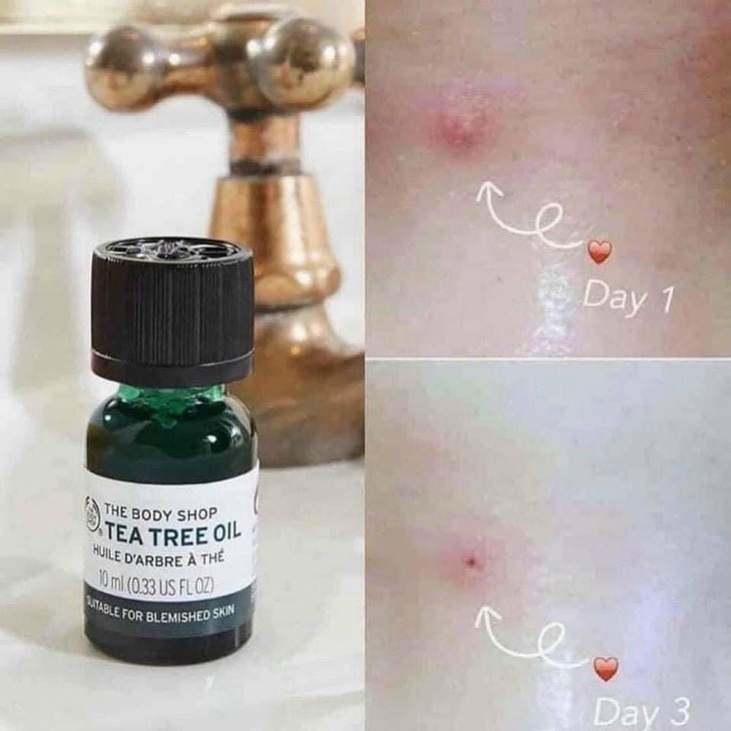 Tinh dầu tràm dành cho da mụn The Body Shop Tea Tree Oil