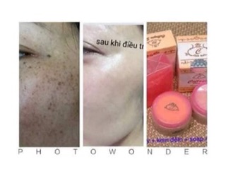 Kem Collagen plus vit e Malaysia