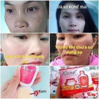 kem face Kone