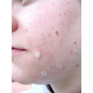 Miếng Dán Mụn COSRX Acne Pimple Master Patch