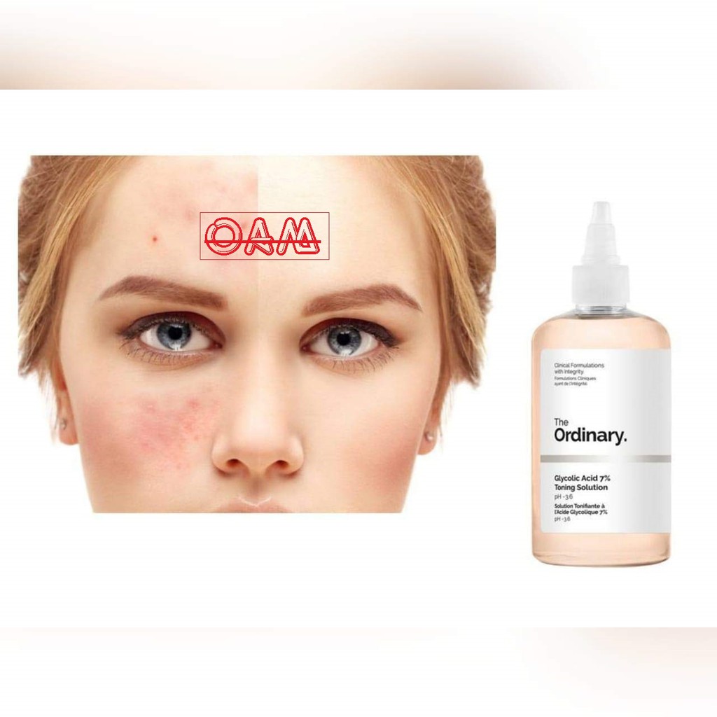 Toner The Ordinary Toner tẩy da chết glycolic acid 7% 240ml Toning Solution "OAM" | BigBuy360 - bigbuy360.vn