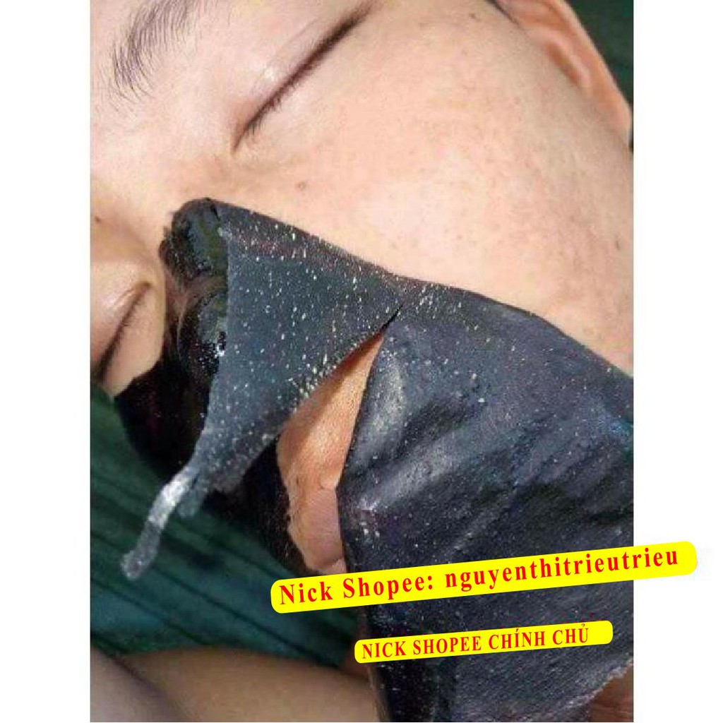 [100% Chính Hãng] Mặt Nạ Gel Hút Mụn Than Tre Hoạt Tính Ngân Bình > Gel lột mụn Than Tre, Lột mụn cám, mụn đầu đen,... | BigBuy360 - bigbuy360.vn