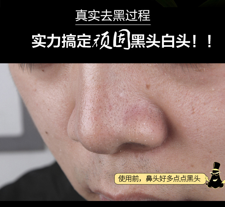 (Hàng Mới Về) 1 Mặt Nạ Than Tre Lột Mụn Đầu Đen Làm Sạch Lỗ Chân Lông Cho Da | BigBuy360 - bigbuy360.vn