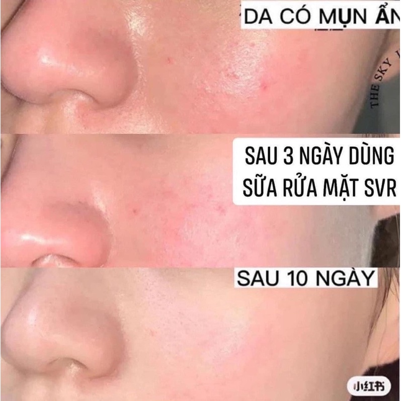Sữa Rửa Mặt SVR Sebiaclear Gel Moussant 400ml - Date 01/2025