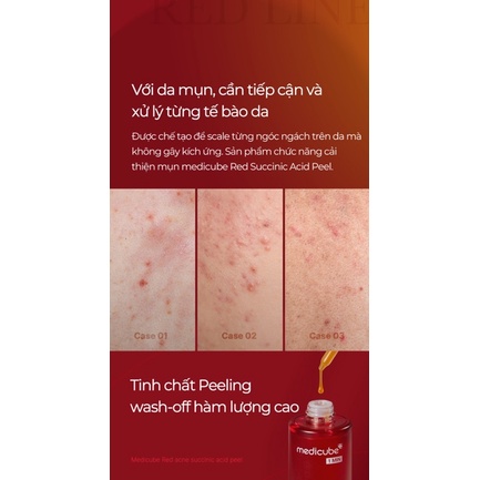 Tẩy bào chết da mặt Peeling Red Acne Succinic Acid Peel Medicube 40g