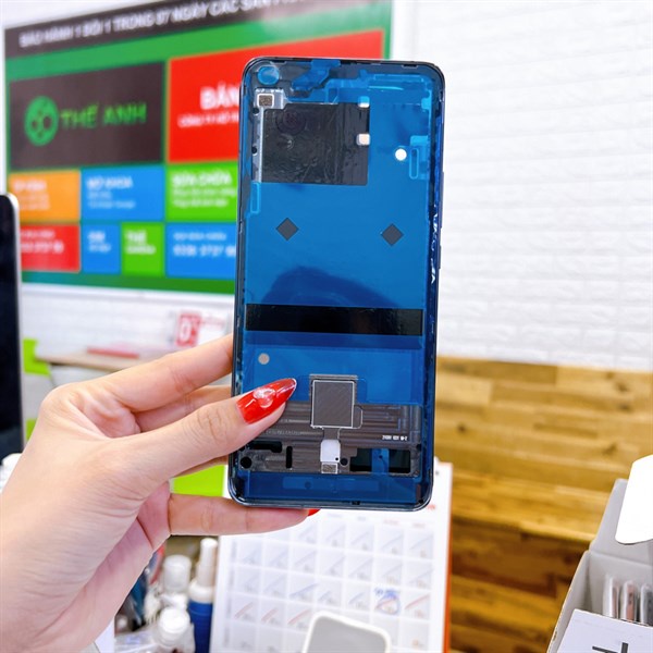 Bộ vỏ Xiaomi Mi 11 (Không kính camera), hàng đẹp nấu máy chuẩn