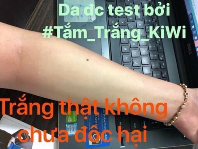 Tắm Trắng Kiwi X3