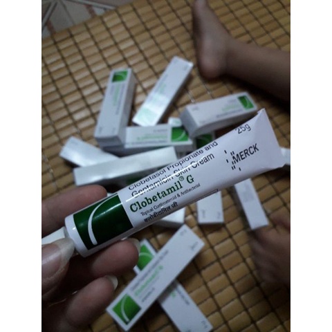 Kem nám, tàn_nhang Clobe-G 25g