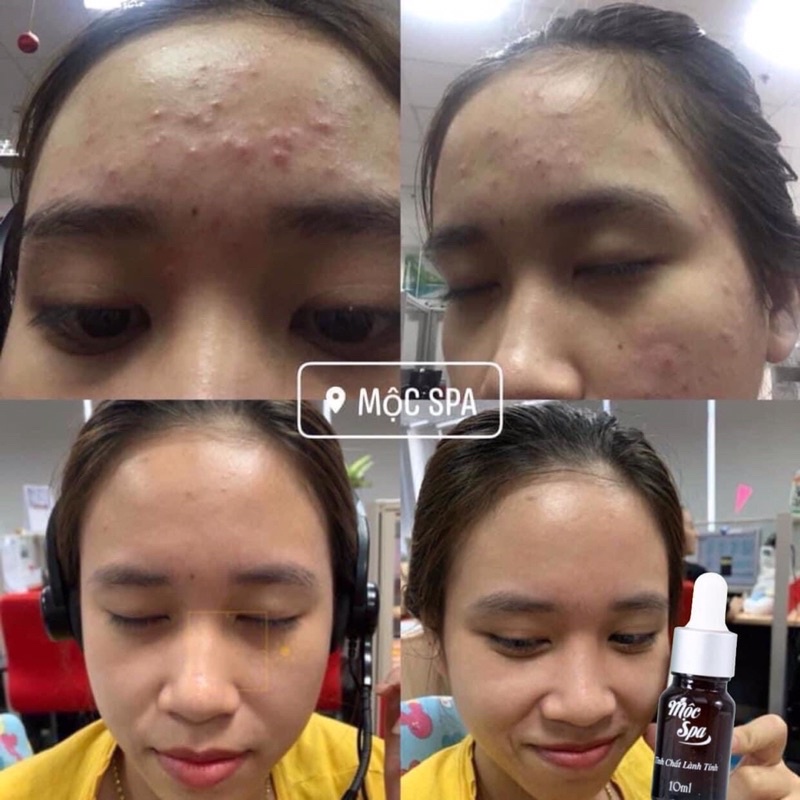 Tinh chất lành tính