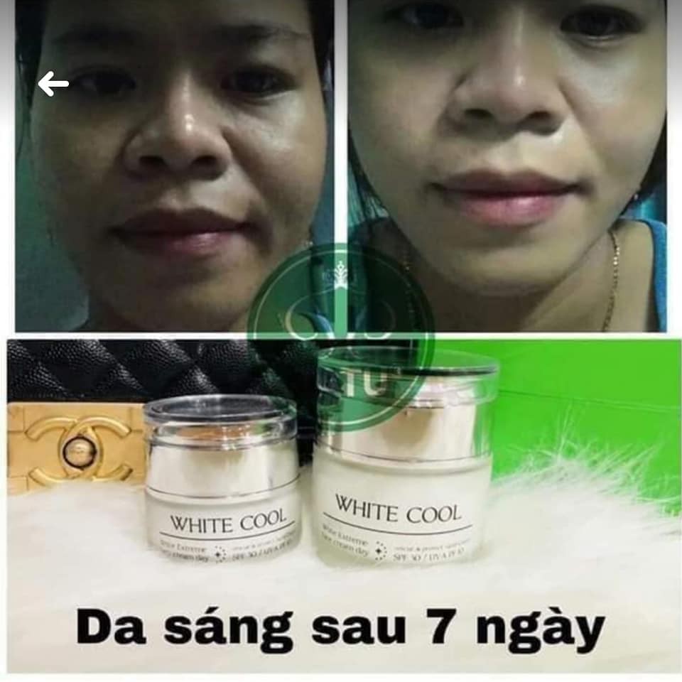 Kem Dưỡng Da Siêu Trắng Giảm Nám Mụn White Cool