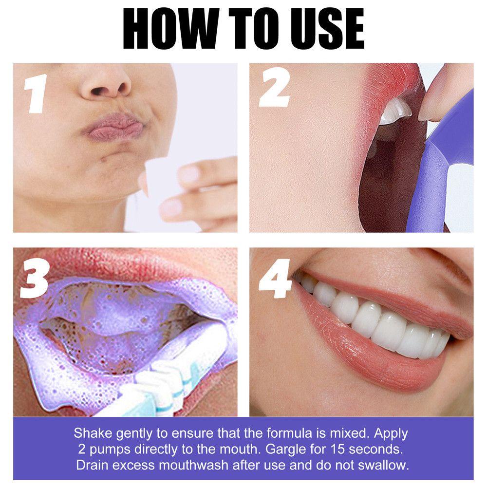 Kem Đánh Răng HS Mousse Loại Bỏ Vết Bẩn Làm Trắng Răng Thoáng Khí