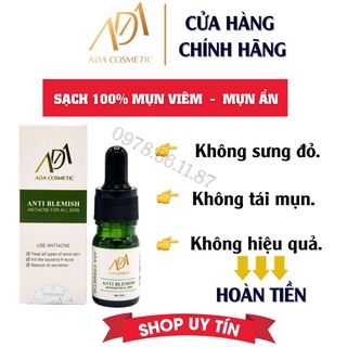 Serum - sạch -100% - mụn - viêm - anti blemish - ada group