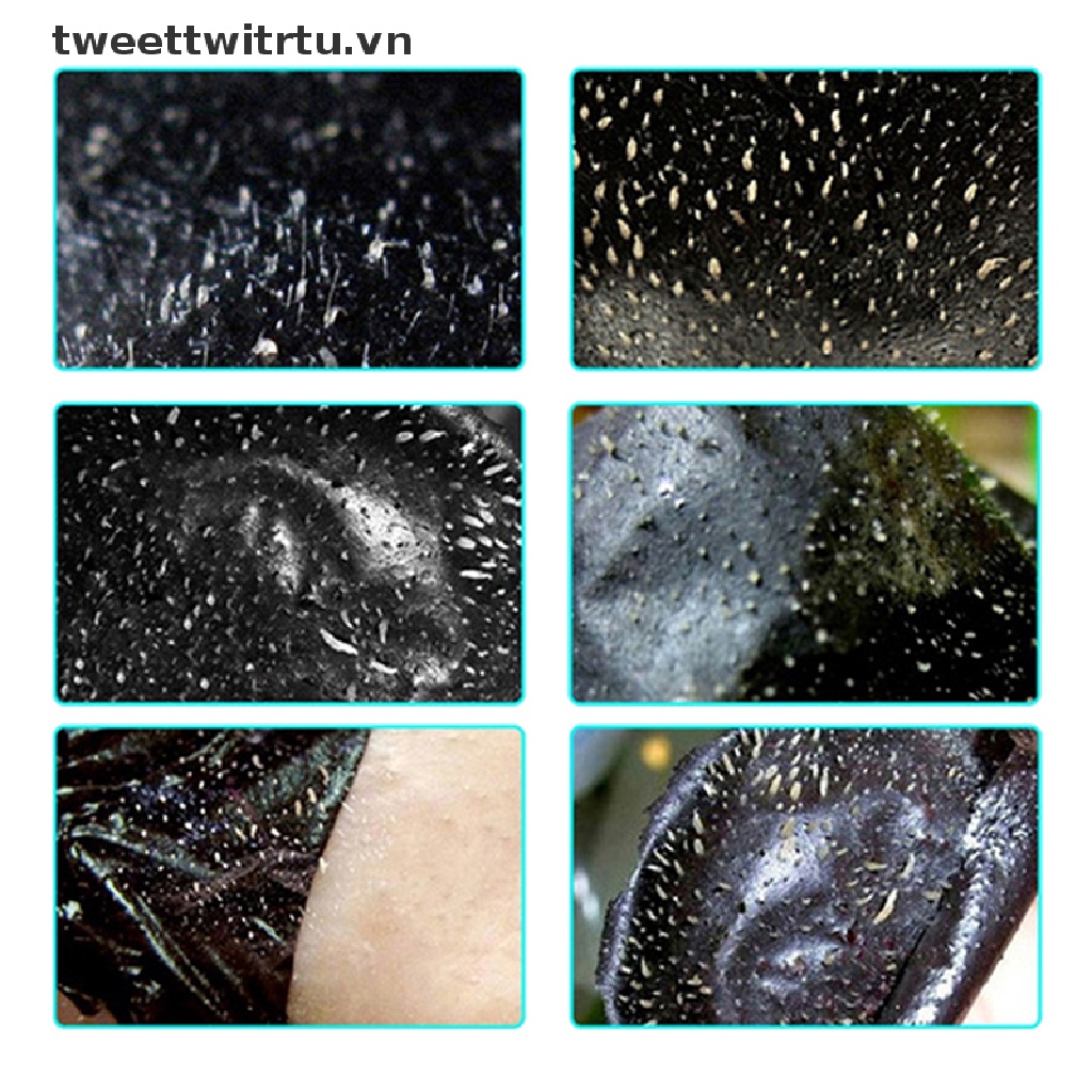 Set 10 Mặt Nạ Lột Mụn Đầu Đen Vùng Mũi Thu Nhỏ Lỗ Chân Lông Làm Sạch Sâu TRWITU