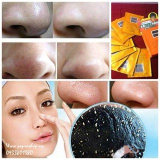 Mặt nạ hút chì Natugo