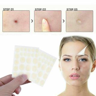 Bộ 24 Miếng Dán Mụn Hydrocolloid Chăm Sóc Da