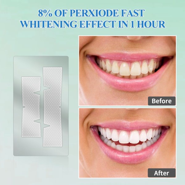 Bộ 10 Gói / 20 Miếng Dán Trắng Răng Cấp Tốc FAIRYWILL FW-337 Super Whitening Tẩy Trắng Chỉ Trong 1 Tiếng Hàng Chính Hãng
