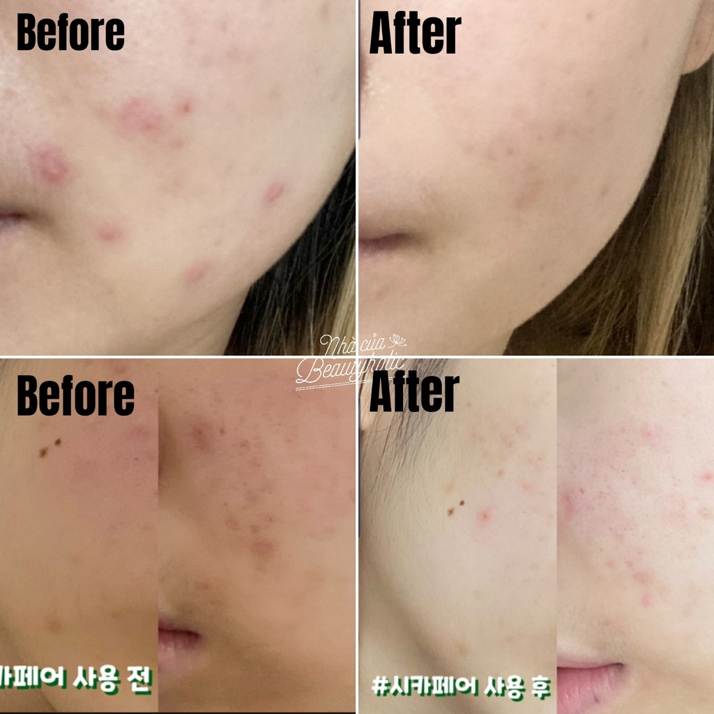 Kem dưỡng phục hồi DR.JART+ CICAPAIR CREAM