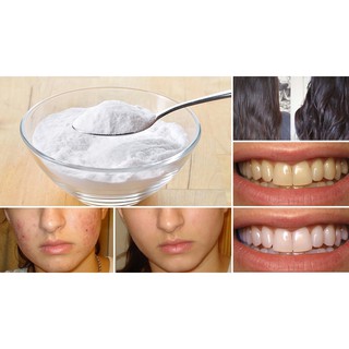 Bột tẩy trắng răng Baking Soda