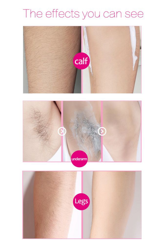 (Hàng Mới Về) Chai Xịt Tẩy Lông 2 Phút Không Gây Đau 20ml | BigBuy360 - bigbuy360.vn