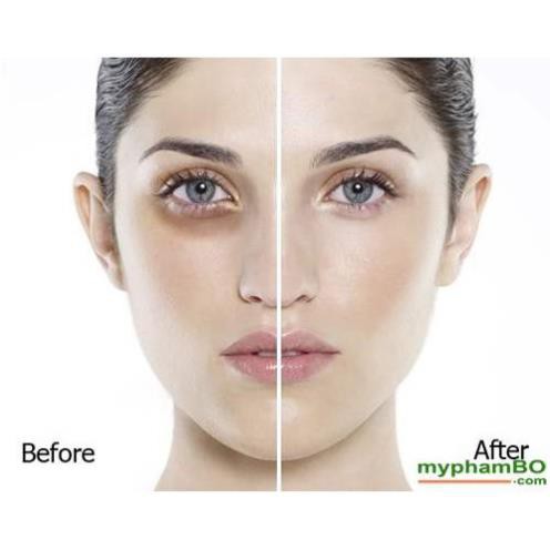 [FreeShip đơn từ 50K] Kem Klirvin ĐẶC TRỊ QUẦNG THÂM MẮT , xóa tan bong mắt trong 1 tháng [chính hãng Nga] G039 | BigBuy360 - bigbuy360.vn