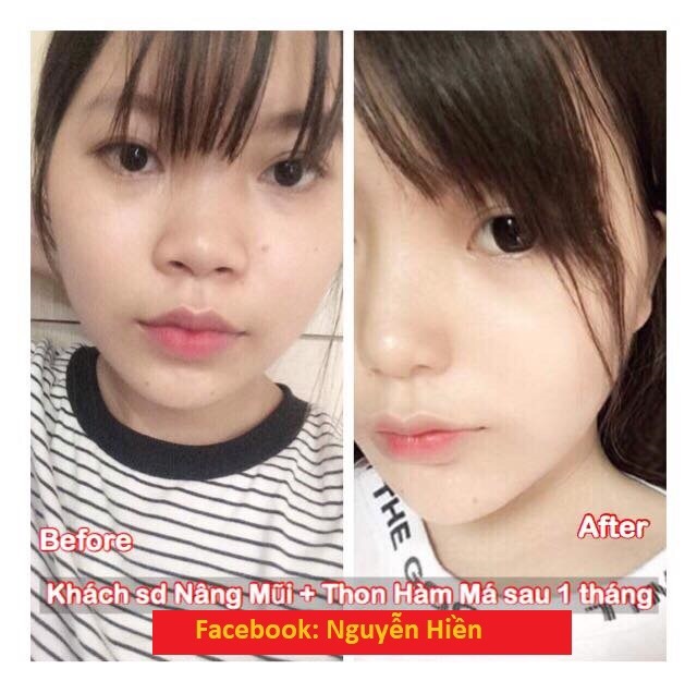 Tinh Chất Thu xương Vline Face Hàn