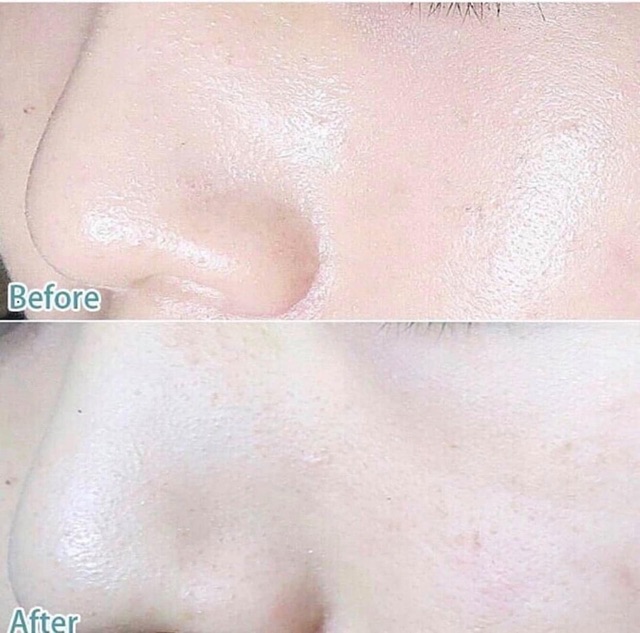 Sữa rửa mặt ngăn ngừa mụn Innisfree Bija Trouble Facial Foam - Guu