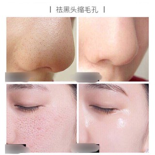 Tinh chất dưỡng shrinkage pore(I-318)