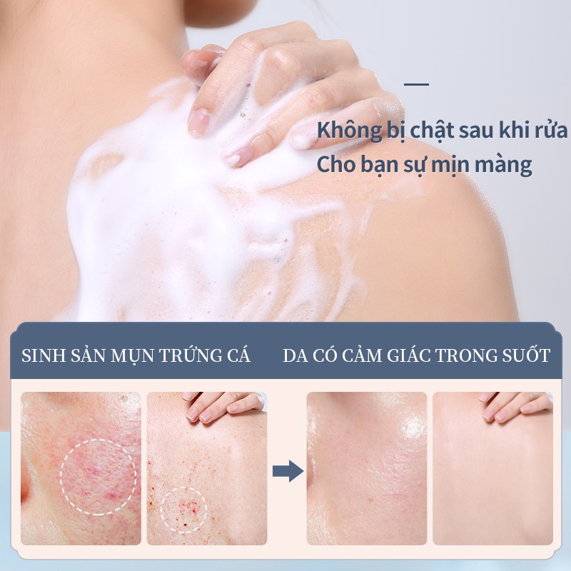 (Hàng Mới Về) Xà Phòng Rửa Mặt Trị Mụn Thu Nhỏ Lỗ Chân Lông Trọng Lượng 100g