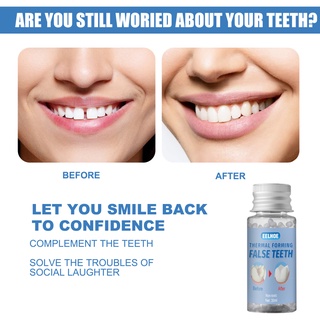 30g Resin Vampire Teeth Glue Temporary Tooth Replacement Material Tooth Filling Missing Denture Adhesive DIY Teeth Repair Dental
 techer