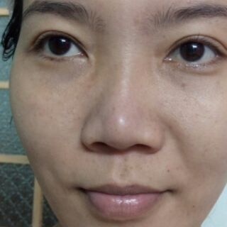 Mặt nạ dưỡng da