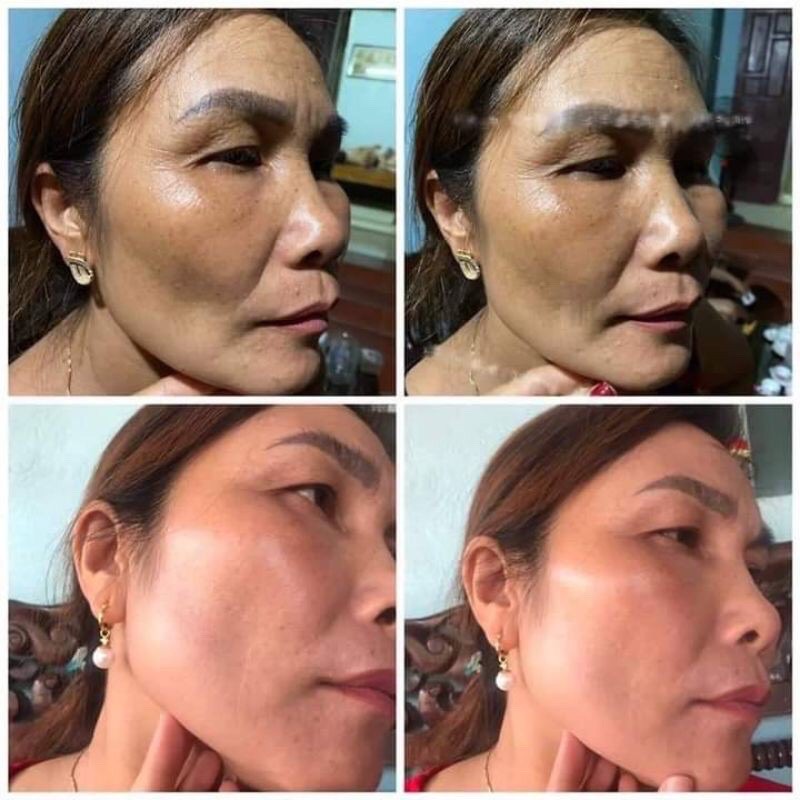 Kem Ủ TRẮNG HÚT NÁM FEMMIU | BigBuy360 - bigbuy360.vn